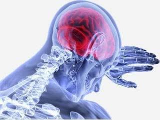Schlaganfall und Neurofeedback